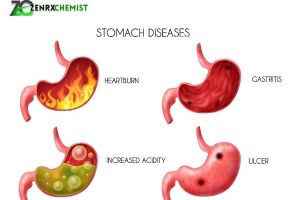 Pan 40 – Composition