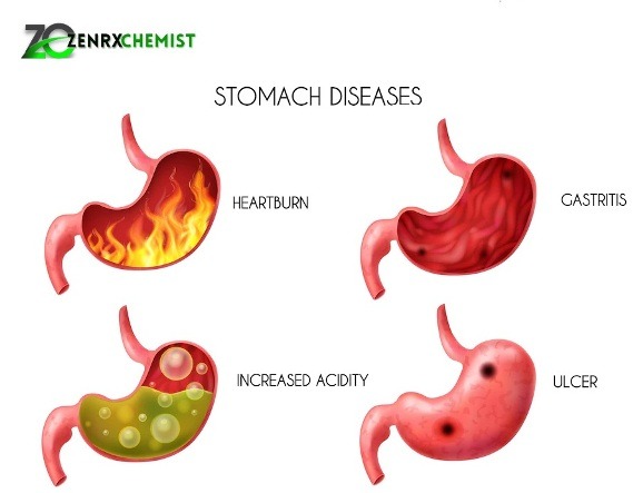 Pan 40 – Composition